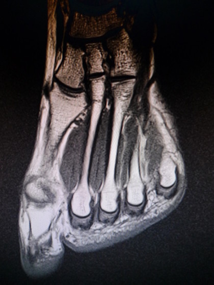 Radiologische Aufsicht Fuß